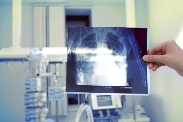 The silica dust from cutting, grinding, and polishing the engineered stone benchtops can lead to potentially fatal diseases as well as lung cancer.