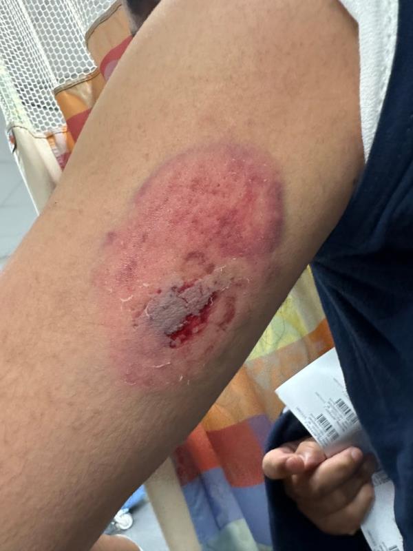 One of the officers was allegedly stabbed in the left arm by Megginson.