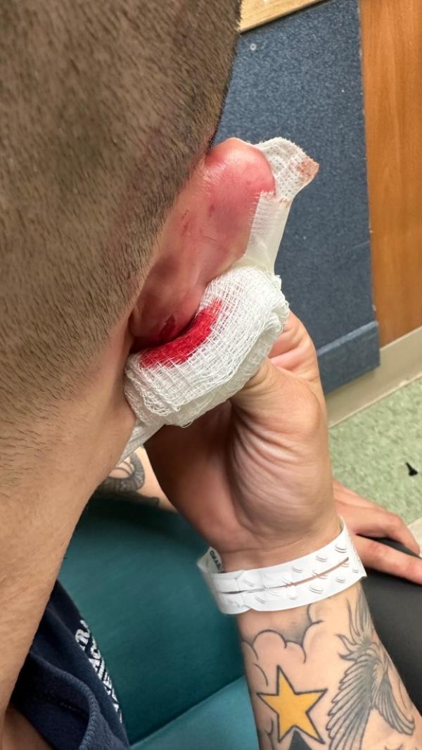 An NYC Correction officer is seen bleeding after inmate Lamar Evans allegedly slashed him on the ear.
