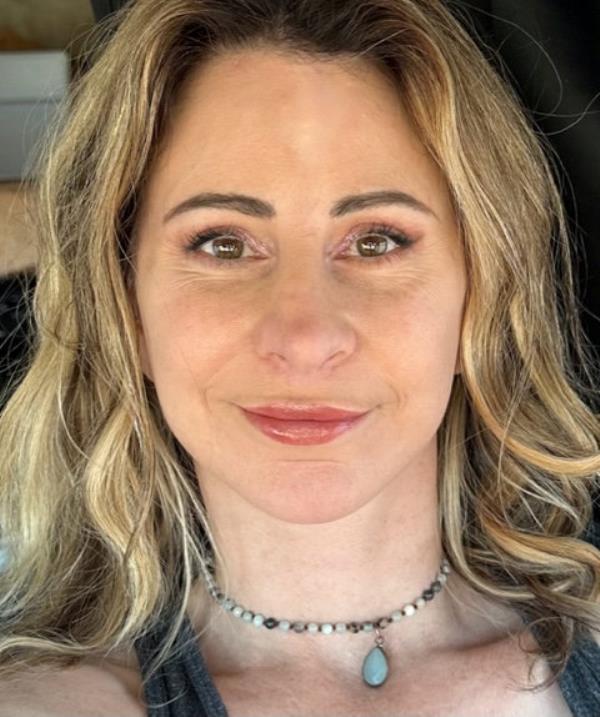In the end, she went for an extended face lift, neck lift, lip lift, and fat transfer from her thighs. 