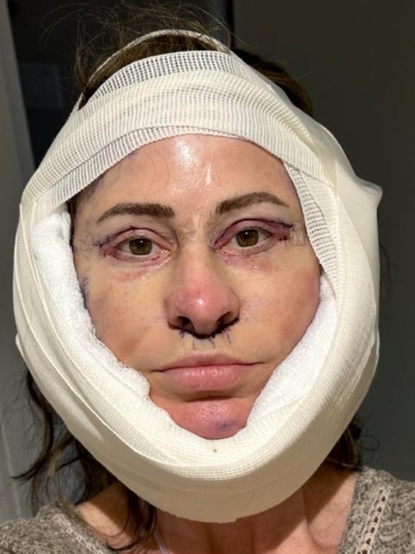 In total, the procedure cost $14,000. 