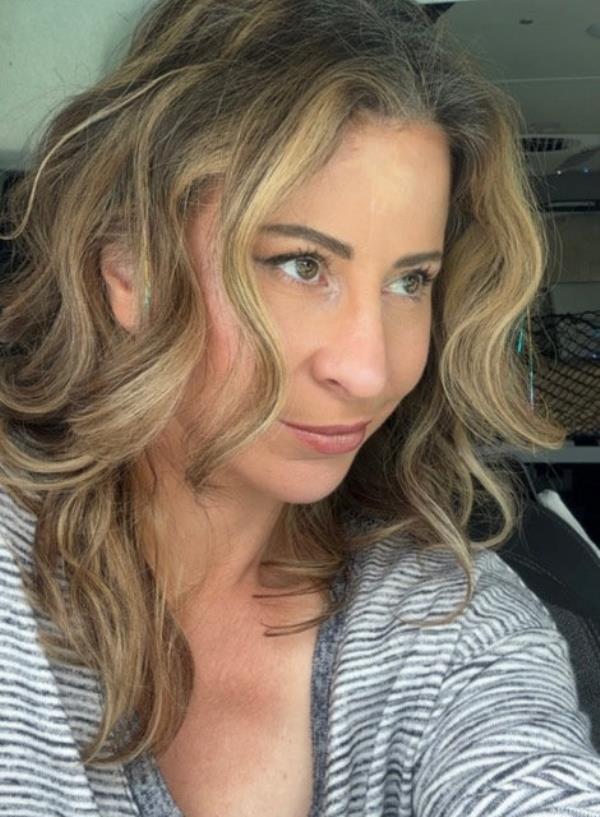 Beasley had seen someone else on TikTok undergo the same procedure in Tijuana. 