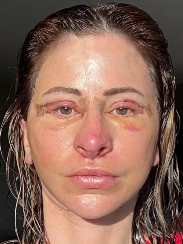 The 50-year-old stayed in Tijuana for a total of six days. 