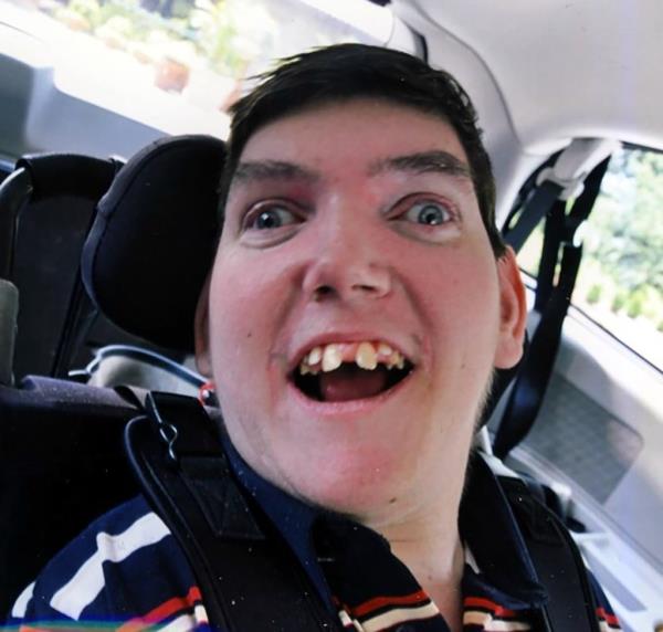 Dowling -- whose family said never crawled, walked, talked or fed himself -- died at age 35.