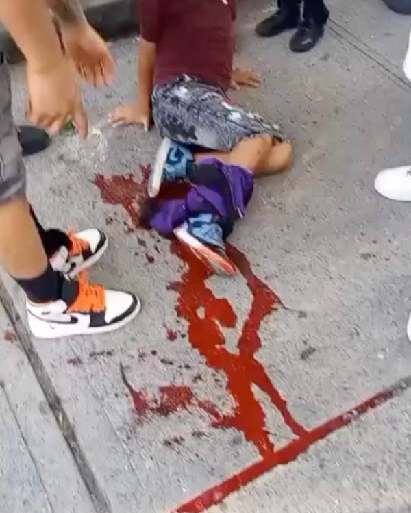 Wounded 6-year-old