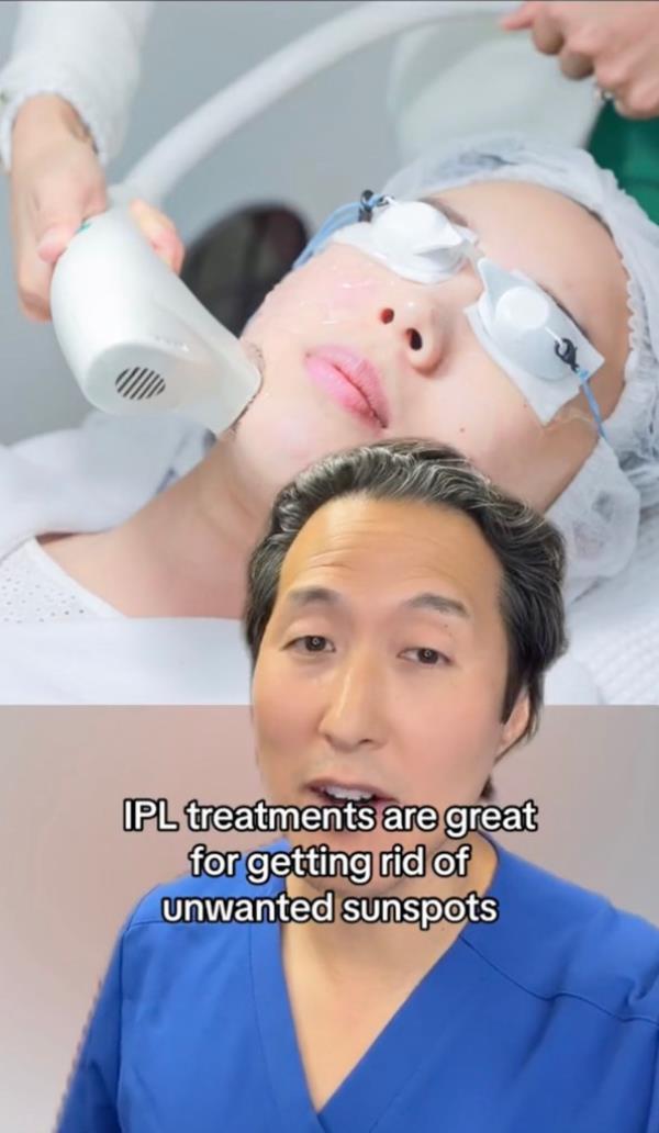 He also suggestions people get IPL treatments. 