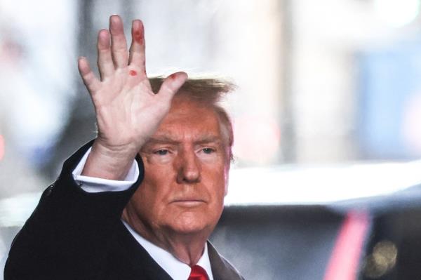 Do<em></em>nald Trump holding up his hand which has three red splotches on it