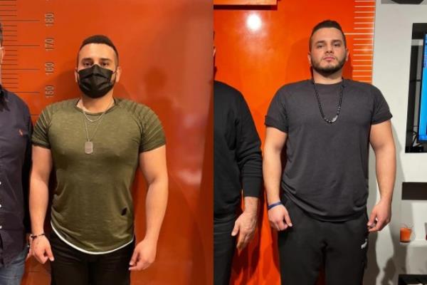 Daniel before and after surgery. 