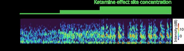A very horizo<em></em>ntal chart plots brain rhythm frequency over time with colors indicating power. Bars along the top indicate the dose of ketamine. After the dose starts more gamma frequency power appears. After the dose gets even higher, the gamma waves periodically stop and then resume.