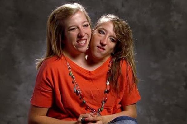 Abby and Brittany. 