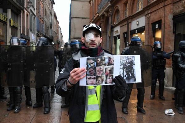 (FILES) An injured protester poses with portraits of people who were allegedly injured in clashes with police during an anti-government demo<em></em>nstration called by the 